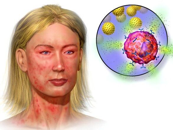 ehinokoki un to klātbūtnes simptomi organismā
